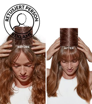 Symbiose Before After Norway